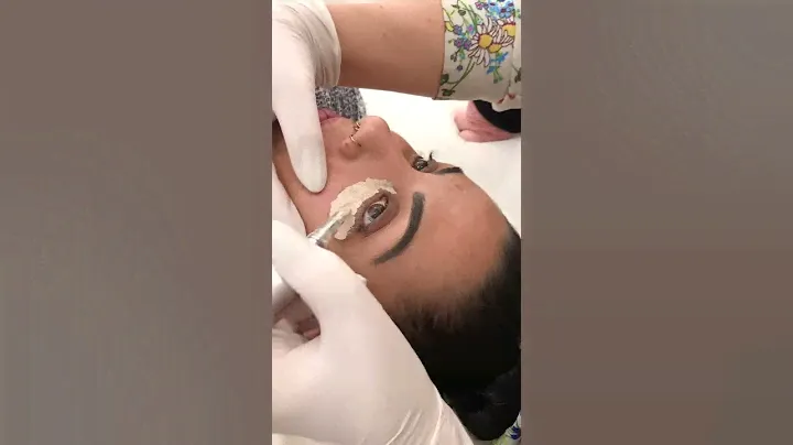 CC EYE Treatment