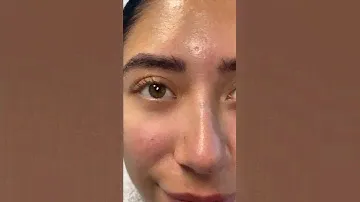 NATURAL UNDER EYE FILLER 👀