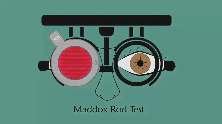 Maddox Rod Test